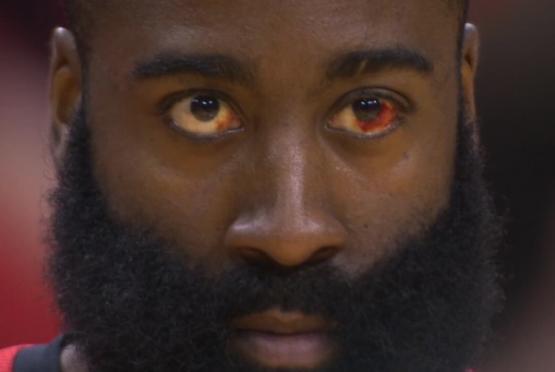 骑士的软肋从与鹈鹕比赛看到骑士两大致命软肋：一是缺乏锋线，个子太矮太瘦，二是中