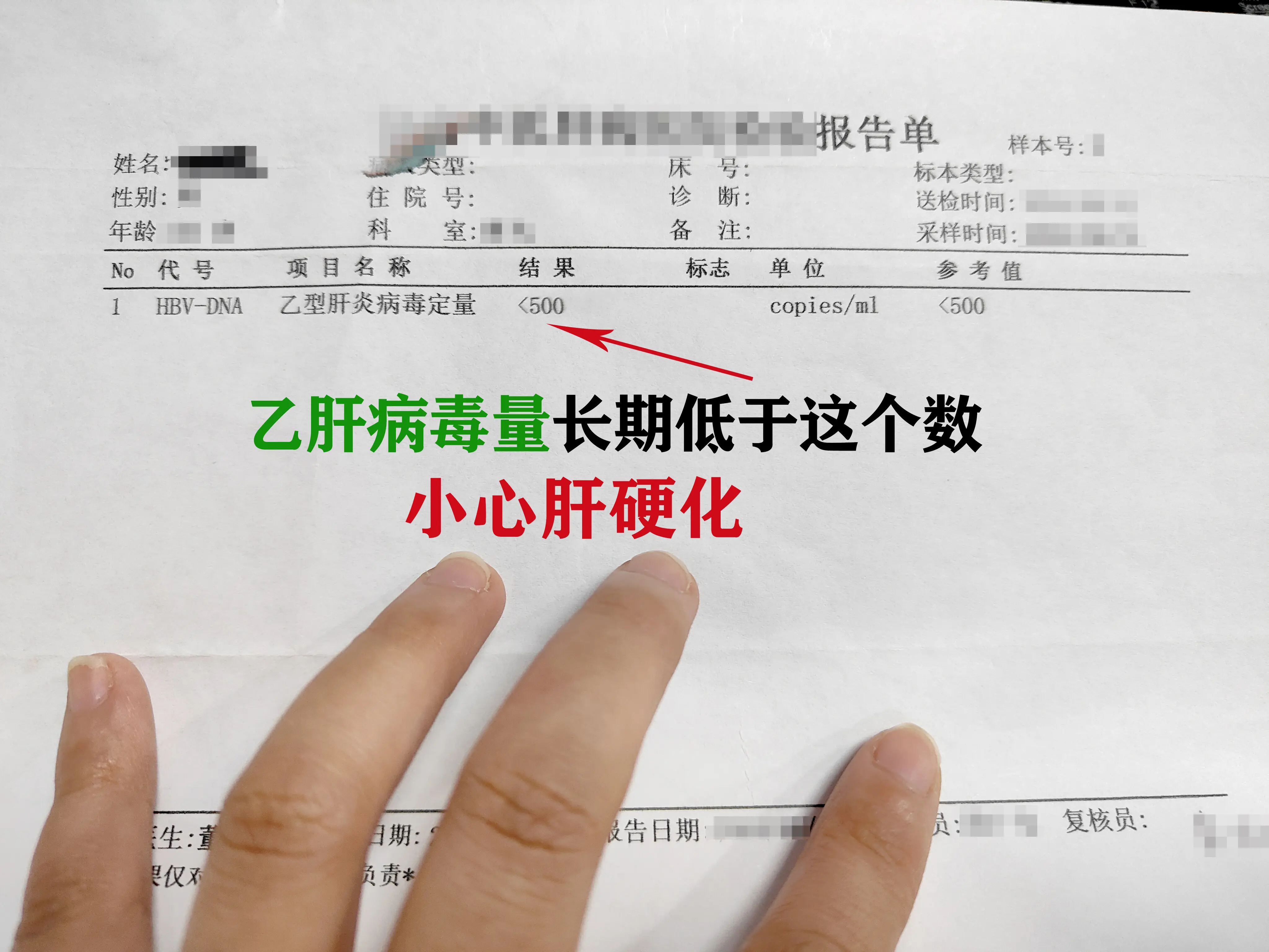 乙肝病毒量低于这个数，反倒要小心 肝硬化？难不成病毒量高就没事？就不会...