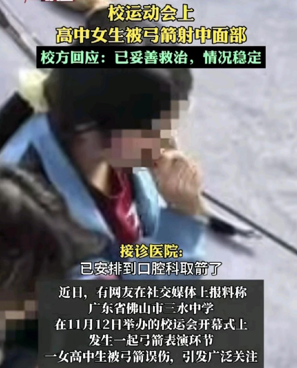 广东佛山一中学校运动会上一名女生被弓箭误伤，射中了脸部，学校回应是全身已经得到及
