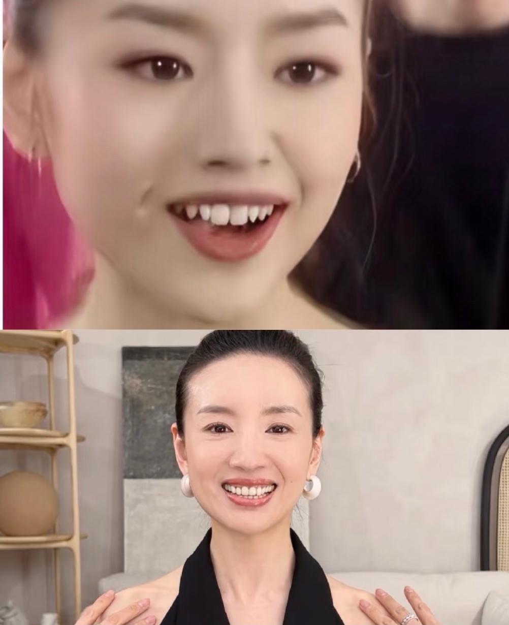 董洁对她的牙齿做了什么，以前的牙挺灵性呀，尖尖的牙像小猫咪后来是贴片了吧整齐