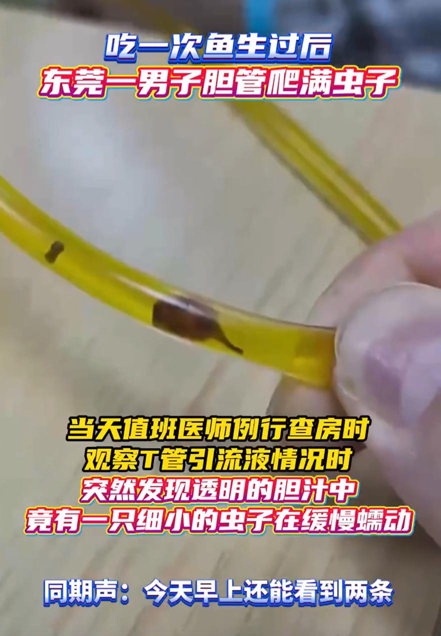 广东东莞，一名40岁男子最近频繁腹痛，到了医院一查发现是胆囊炎加胆总管结石，万万