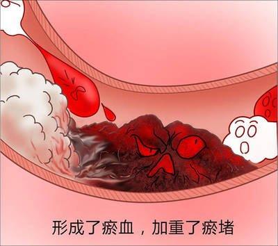 身体有三堵，痰湿，血瘀，气滞。乱补只会是火上浇油！ 之前接诊了一位朋友，夜起