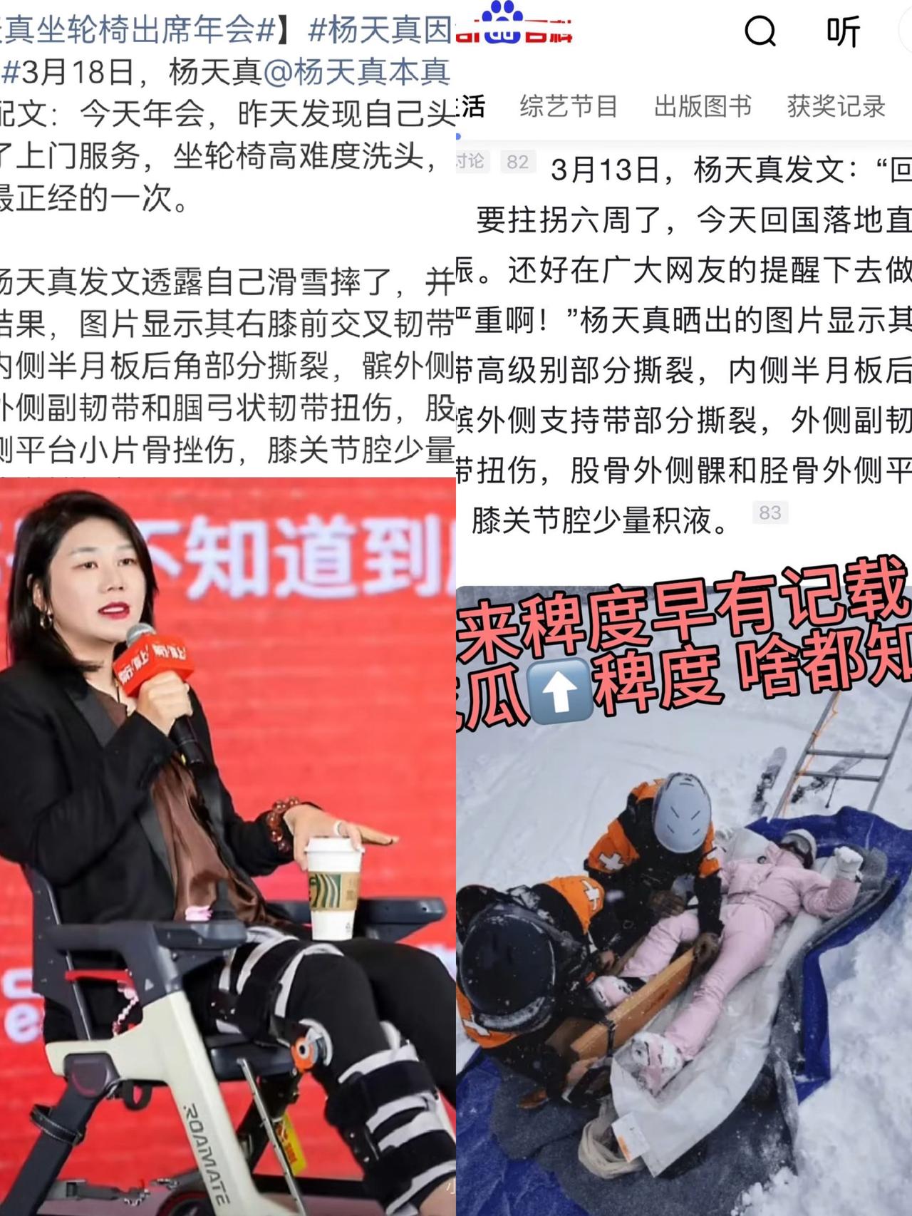 太佩服杨天真了她说减肥直接减了50斤她摔断了腿，坐轮椅也要去参加年会