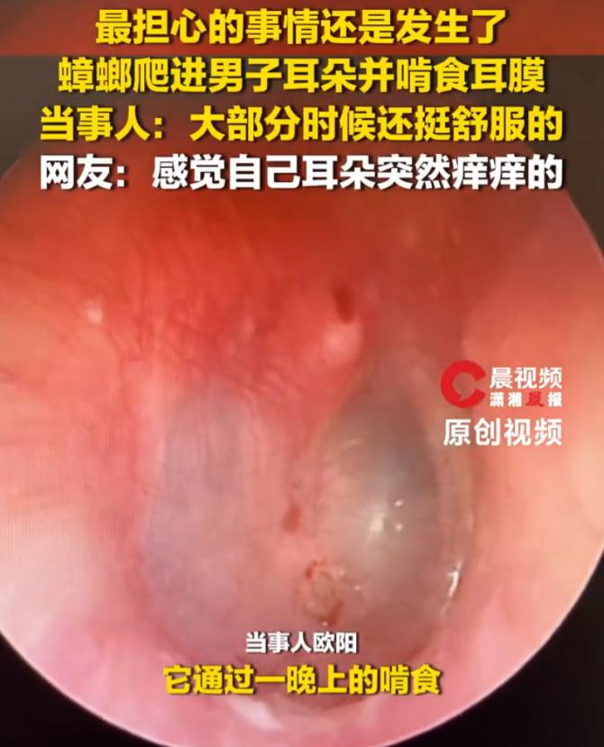 5月28日深圳新闻网报道了一起令人脊背发凉的意外：一只蟑螂深夜钻入男子耳道，整整