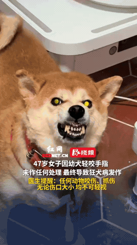 长沙，一47岁女子身体不适前往该院就医，后被确诊狂犬病发作。经医生询问得知，女子