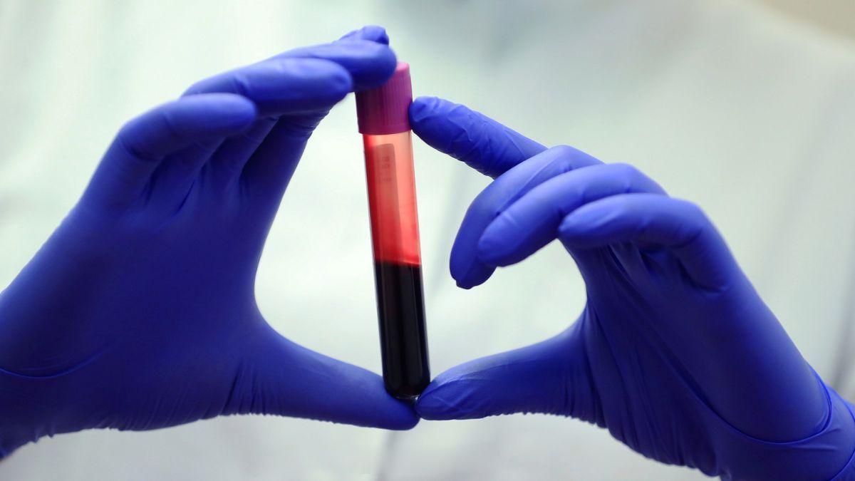 超长寿人群身体多个关键指标与普通人存在明显差异研究人员通过分析超长寿人群（如百