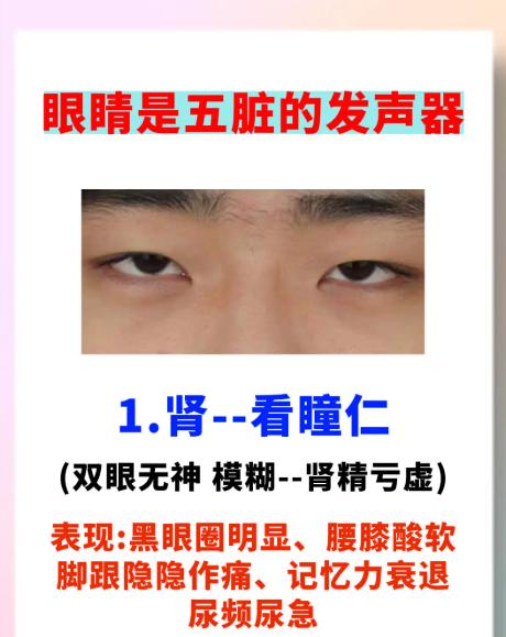 眼睛是五脏的“晴雨表”，这些表现你中了几个？