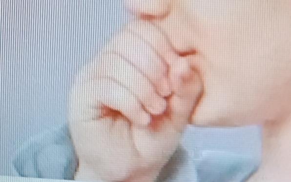 痰多真的太难受啦，给大家分享几种化痰食物。首推梨，它水分足，清甜可口。像冰糖雪