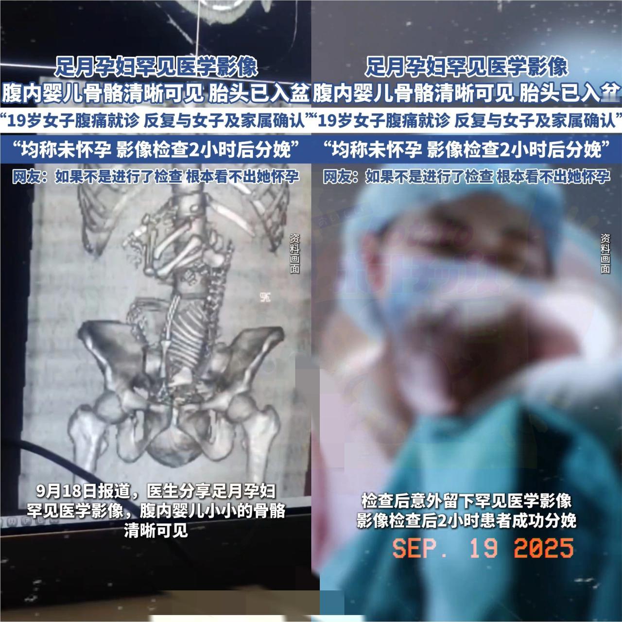 19岁姑娘捂着肚子喊疼冲进医院，医生反复追问“是不是怀孕了”，她和家属拍着胸脯说