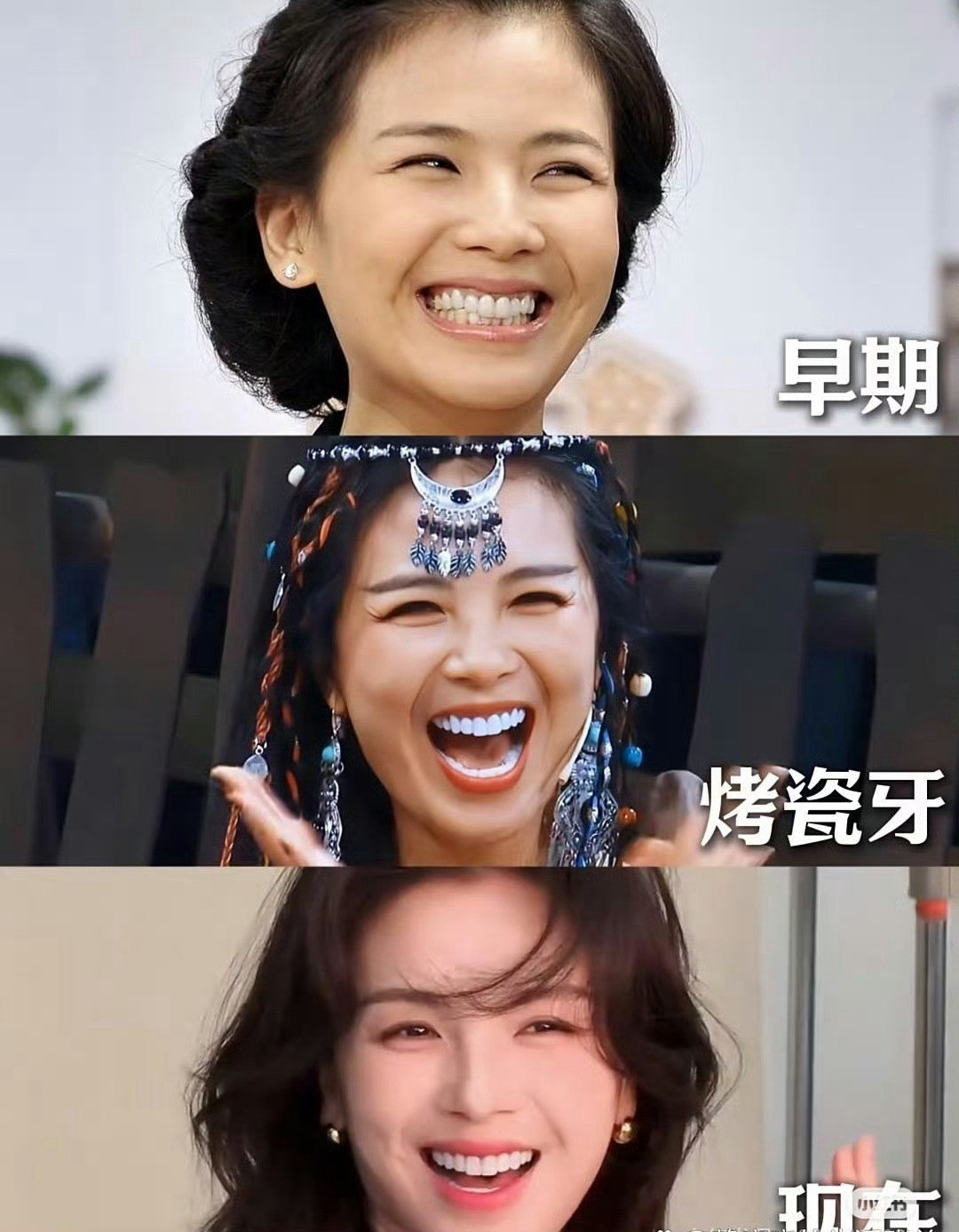 据说刘涛这口牙花费三百万，你觉得值吗