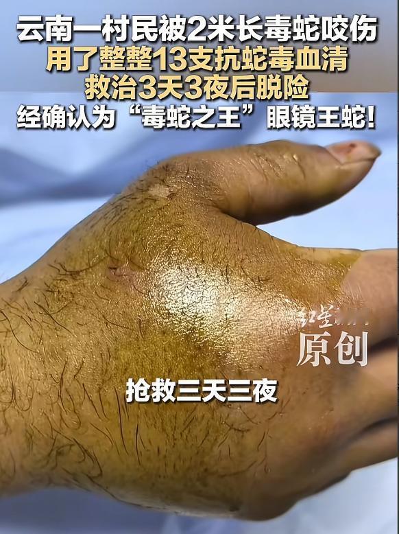 5月10号，刷到一条新闻，看得我心都揪起来了，就在前两天，4月24号，云南昭通一