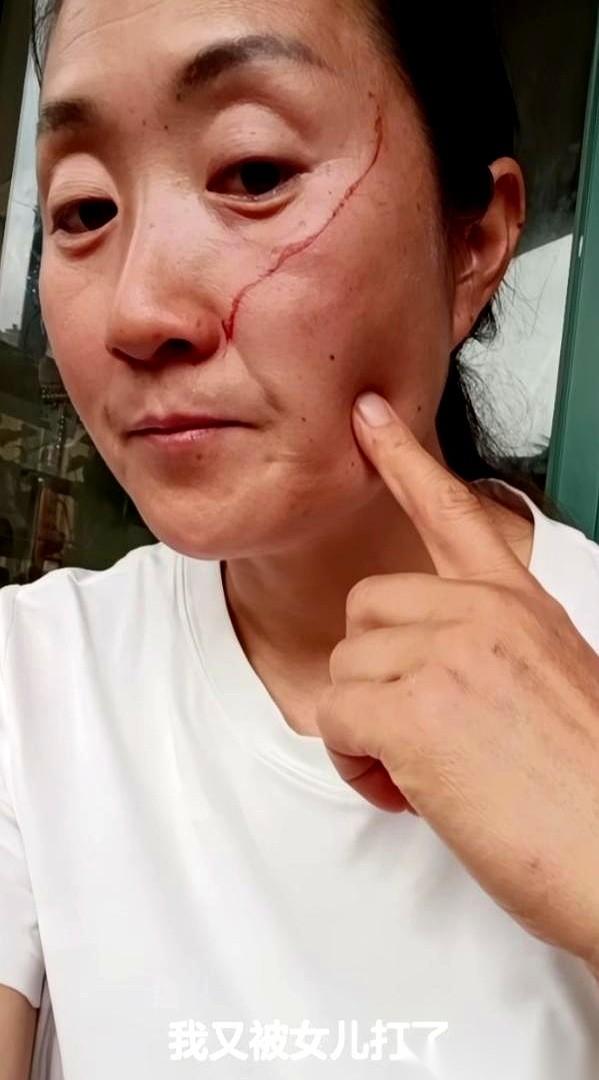 一年三百六十五天的当牛做马，换来的是亲生闺女甩在脸上的一个巴掌。脸破了，血印子