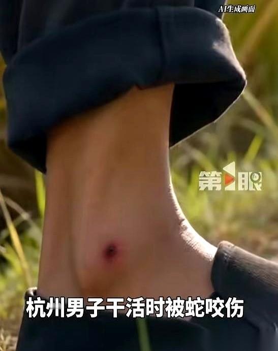 杭州的秦大哥看着左小腿冒血的两个细小窟窿，不仅没喊救命，反而一把攥紧锄头把子，冲