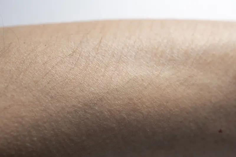 为何有人显老，有人显年轻？答案就在这28点其一：不爱喝水，皮肤干如脱水的水果。