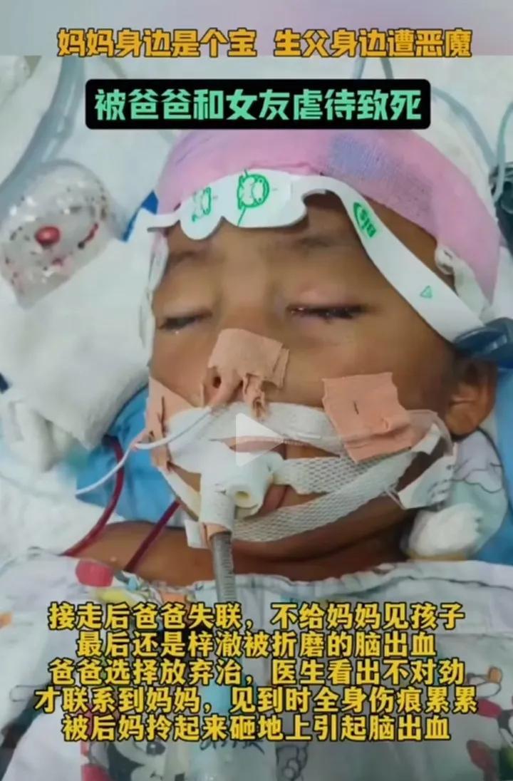又一起虐童案！上海3岁男孩被父亲女友虐待致死案真是触目惊心！孩子父母离婚，孩子被