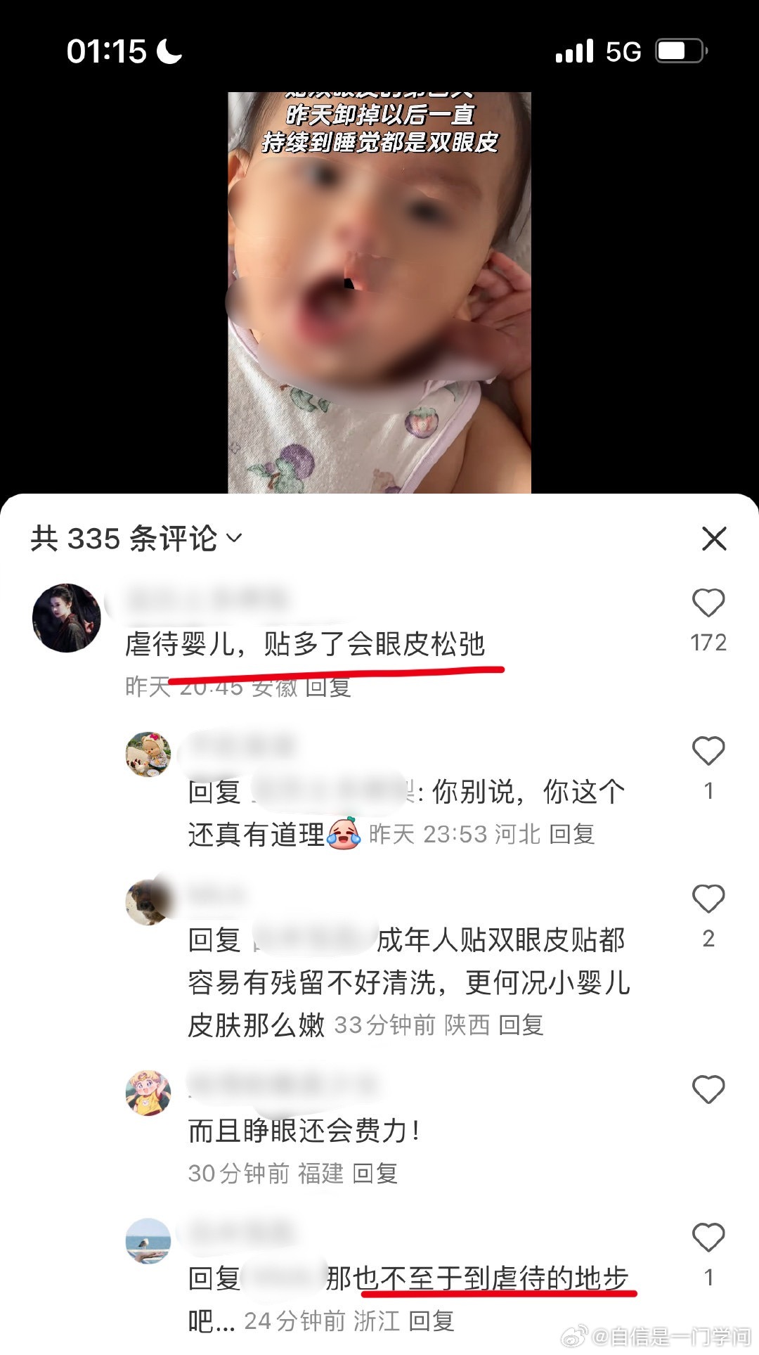贴个双眼皮而已？？？你们还有一点下限吗？​​​