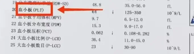 肝硬化患者要关注血常规这一指标！ 血小板计数下降可能导致凝血功能的异常...