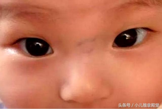 小儿推拿加一个糕点, 双管齐下调脾胃, 孩子出现惊喜变化!