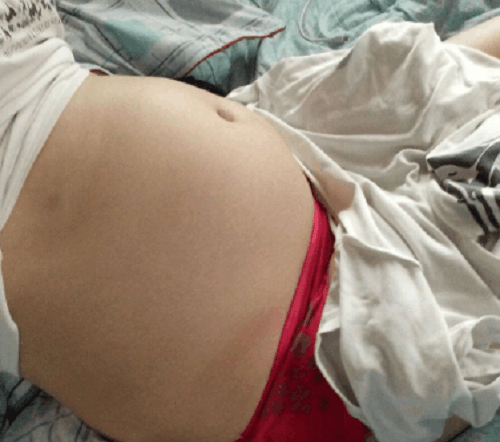 宝宝肚子痛, 妈妈用胃药治, 宝宝面黄肌瘦送医, 医生: 谁说是胃病