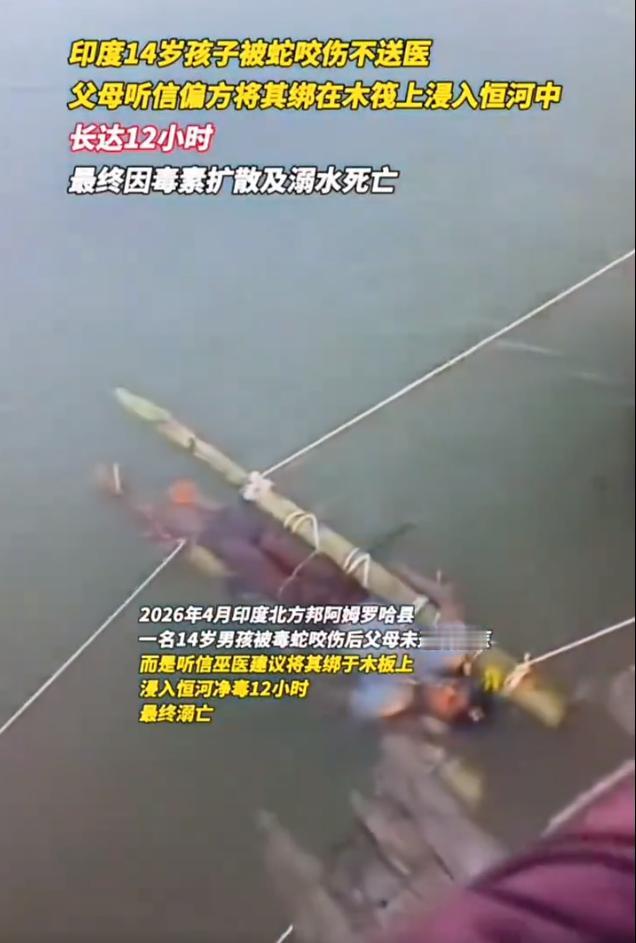 真是愚昧又可怜！印度一名14岁男孩被烈蛇咬伤，父母不信现代医学，反而听了术士