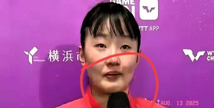 家人们，谁懂啊！横滨冠军赛的医疗暂停，今天裁判处理结果出来了，但这并不能掩盖赛