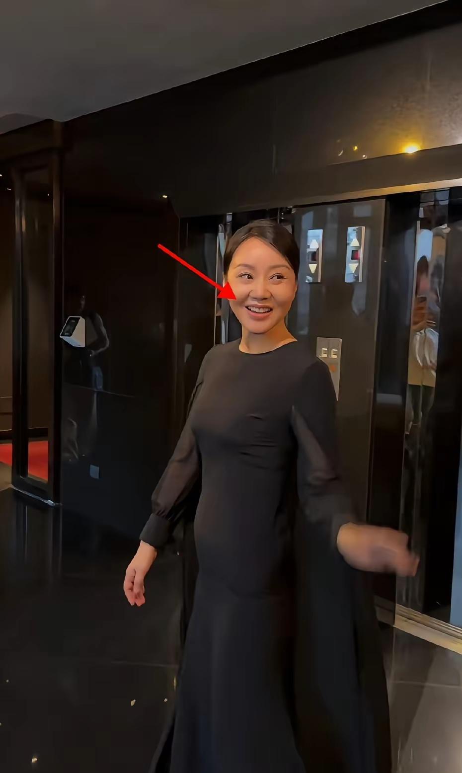 54岁的闫妮亮相米兰时装周，微醺模样十分迷人，然而脸部肿胀僵硬，略显不自然。闫