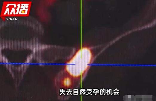 有一则广为医学界引用的临床案例：一名年轻女性先后8次妊娠，前5次是非意愿