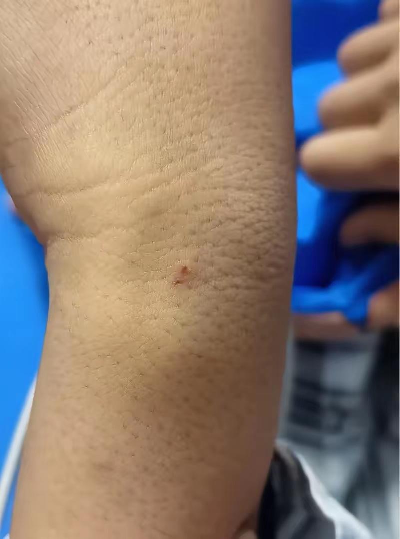 湖南这老师的操作我真的要吹爆！9岁男童在操场被短尾蝮蛇咬了，有人说老师不先打蛇太