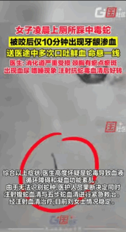 云南60岁女子凌晨上厕所踩中毒蛇，仅10分钟后出现牙龈渗血！最可怕的是，女子并不