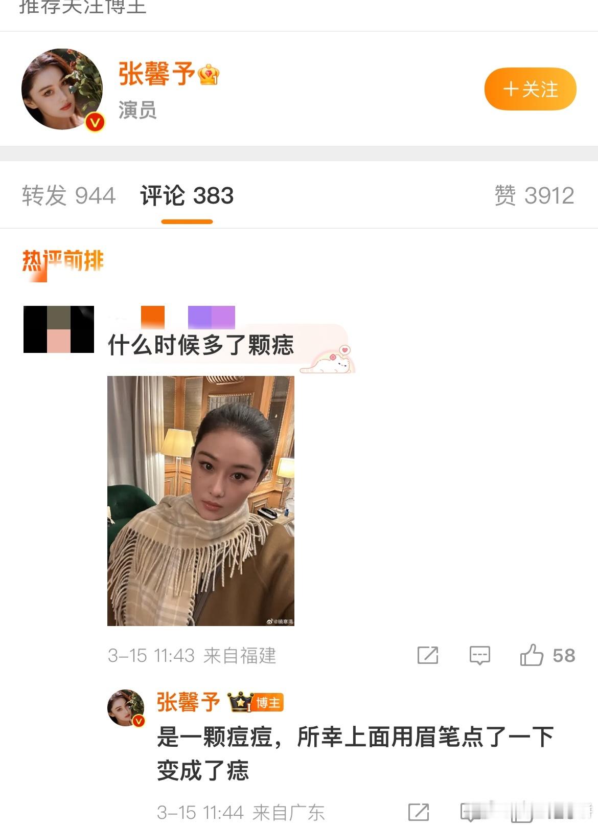 张馨予把痘痘点成痣好完美的一张脸好完美的骨相张馨予｜​​​