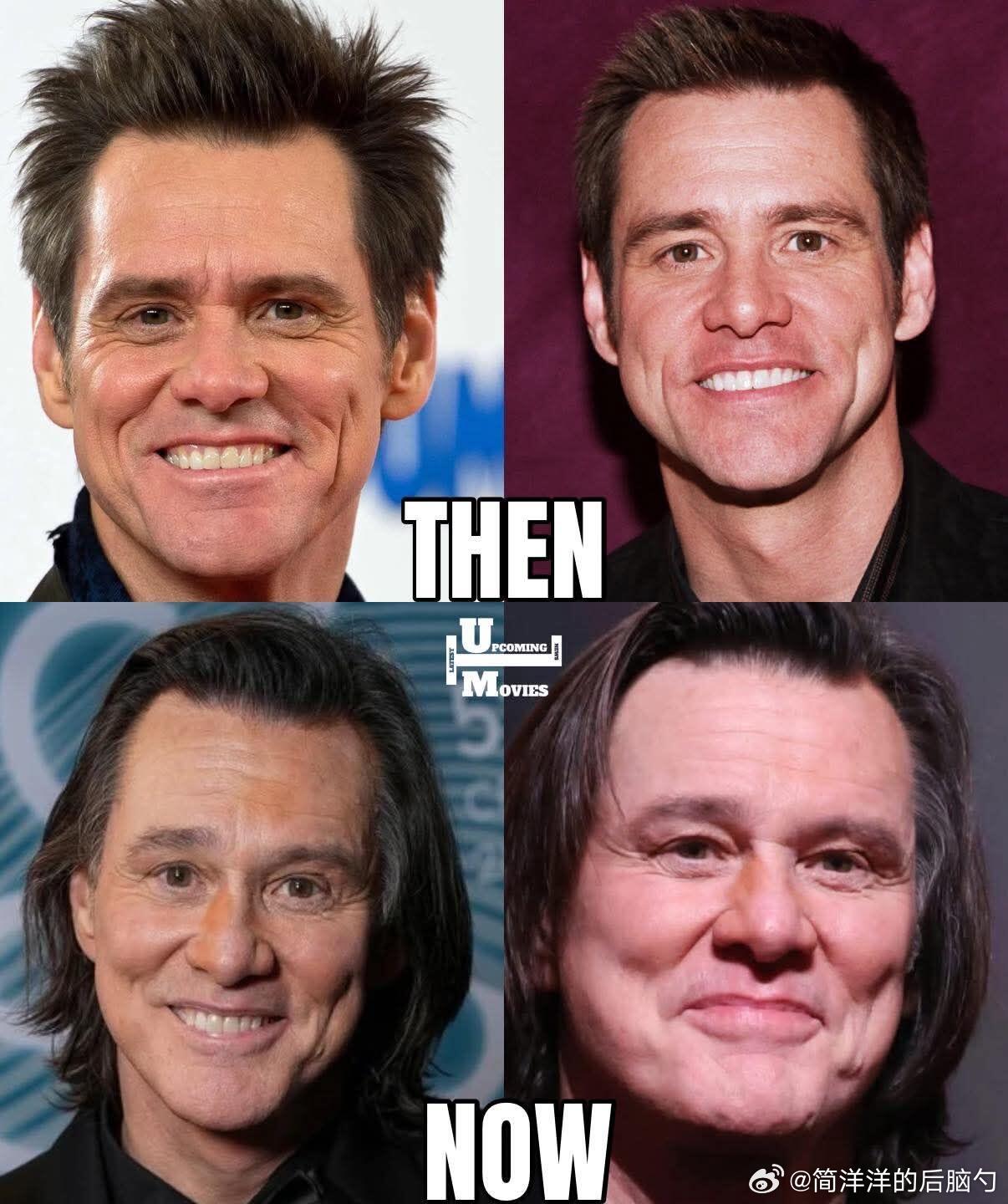 好神。。因为凯撒奖颁奖典礼上金·凯瑞做了医美面相和以往不同，导致外网现在质疑金·