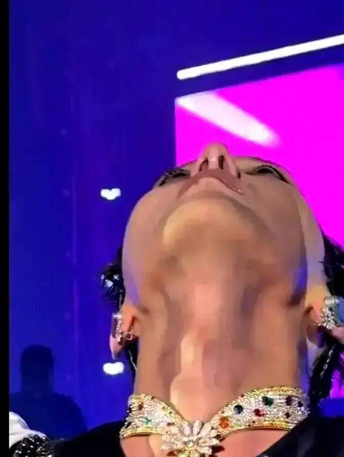 鼻整形医生递给你一张术前协议，第三条用灰色小字印着：“术后可能永久丧失跑步能力。