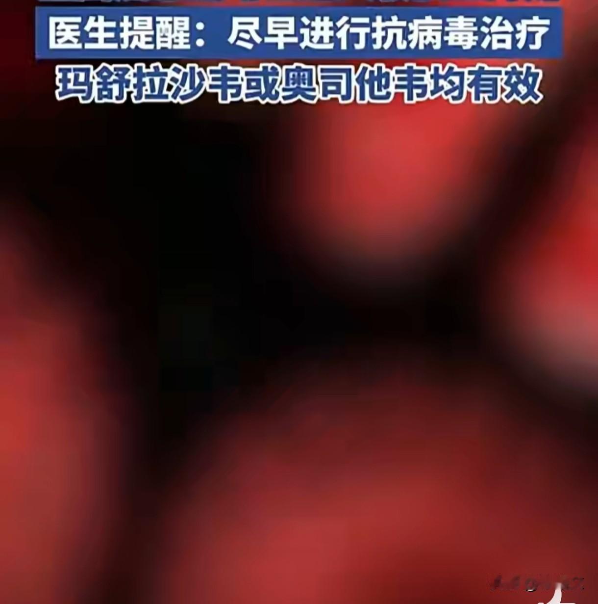 甲流H3N2来势汹汹！严重可致呼吸衰竭，48小时内用药是关键最近流感高发季