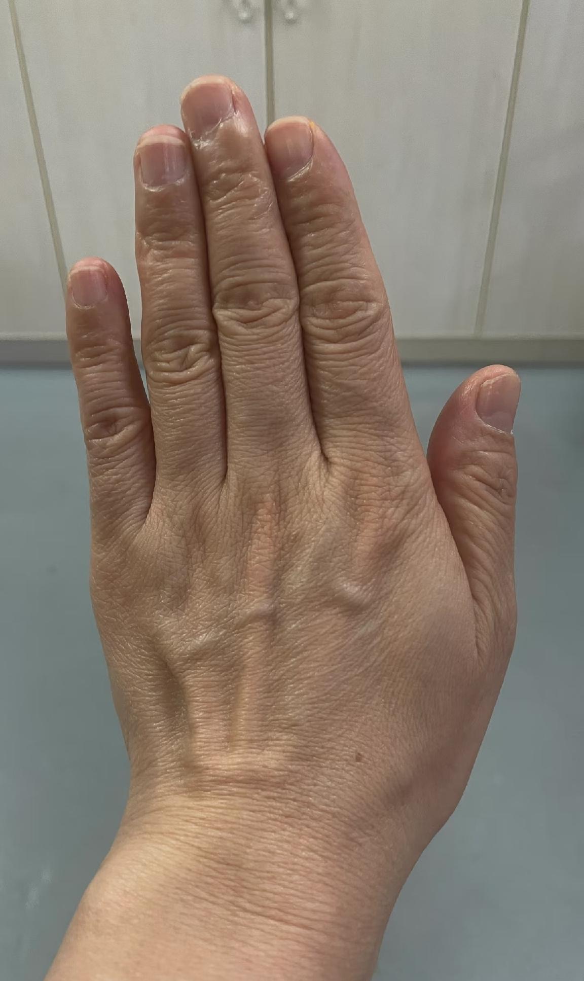 太崩溃了！我是72年的牛，今年54岁，最近有一个令我特别痛苦的事，我不能睡觉