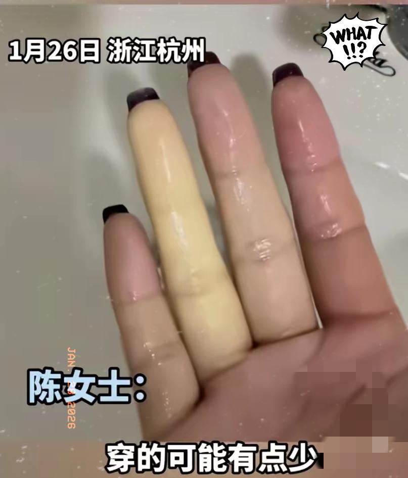 浙江杭州一位女子手部遇冷后，发觉有一根手指发麻，无名指变得惨白、毫无血色！到医院