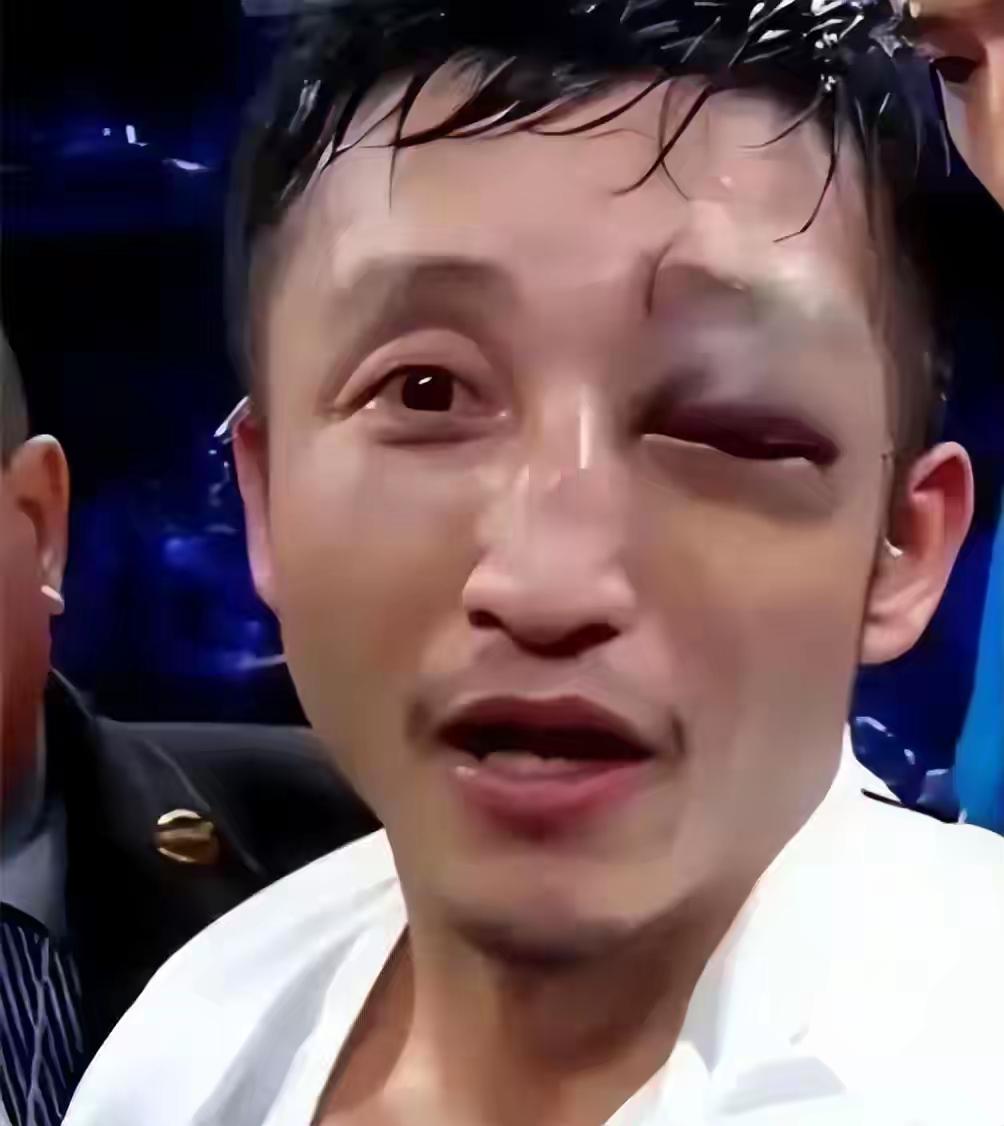 靠一拳一拳打来的2个亿，三年完美亏完了，还负债累累，昔日拳王邹市明退役后经商，由