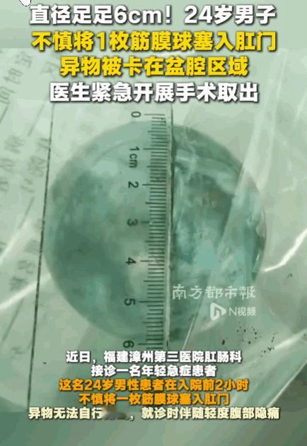 悲剧还是发生了！福建漳州，一24岁男子因一时糊涂，将一枚直径6厘米的蓝色硬质筋膜