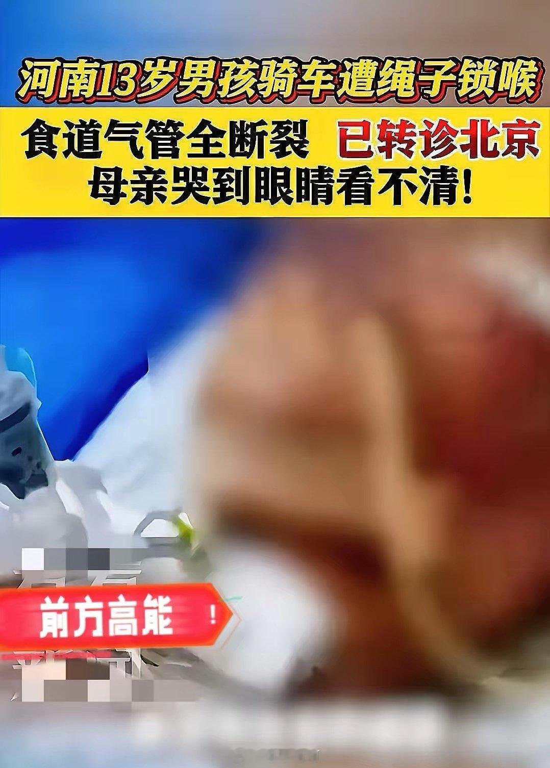 真的看哭了！河南被割喉的13岁男孩，已紧急转至北京儿童医院救治，至今仍躺在ICU