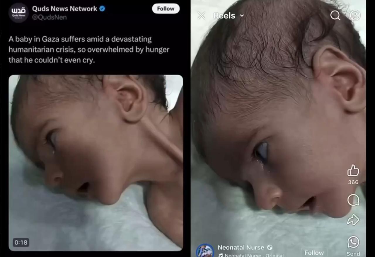 捏造的痛苦并非证据，而是宣传！这段新生儿癫痫发作的视频来自Facebook上的一