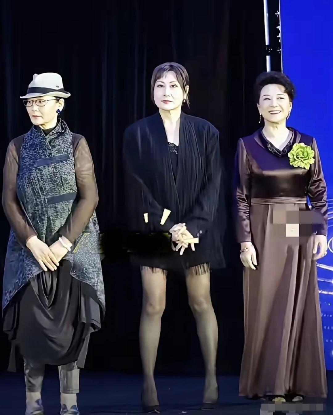 我的妈哟，张凯丽这双叉着双腿的站相，真是让人无语，丑陋至极！一把年纪还露着大腿，