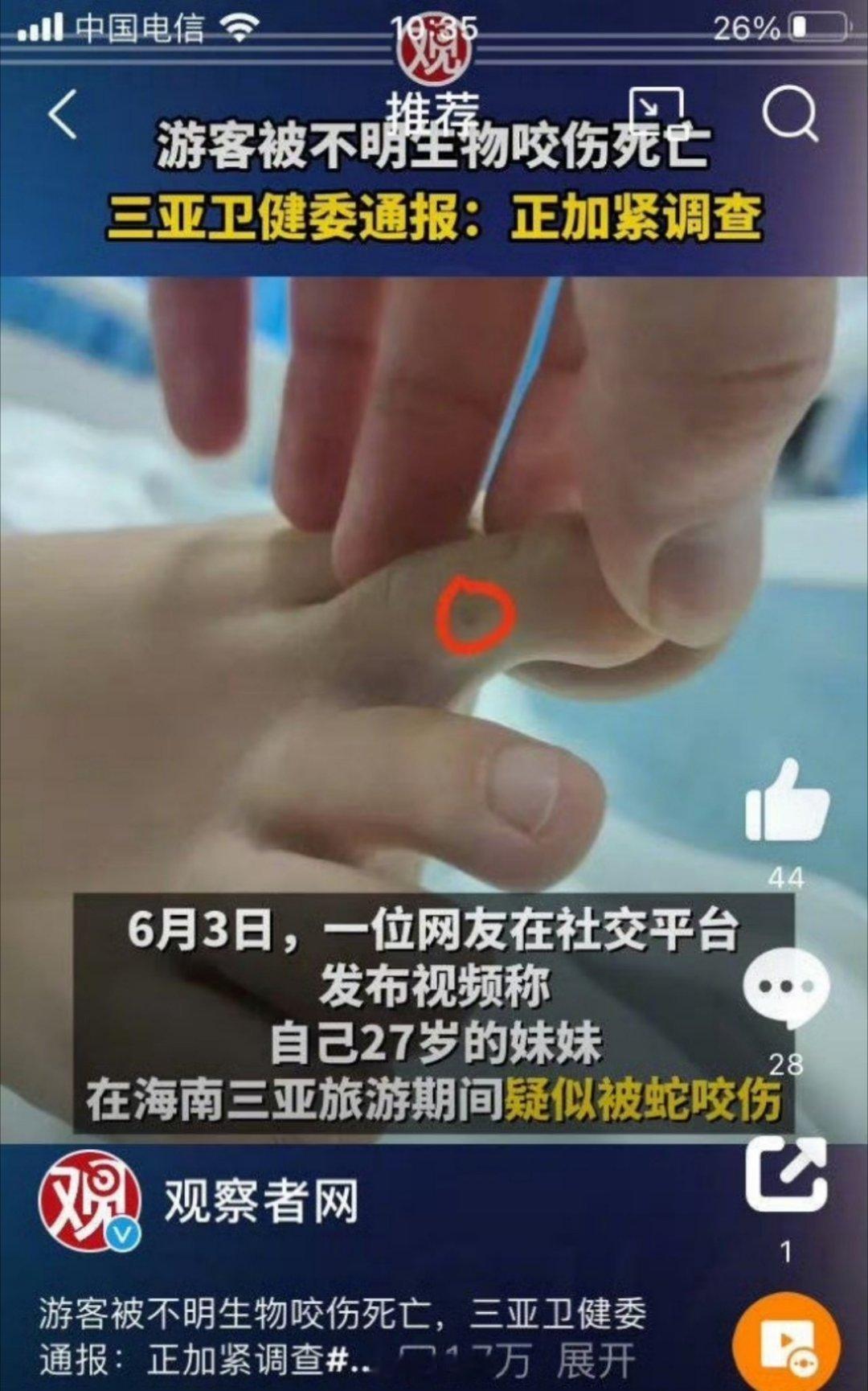 海南有74种蛇类毒蛇27种媒体还在不断恐吓网友，听听这方面的医生怎么说的吧，更