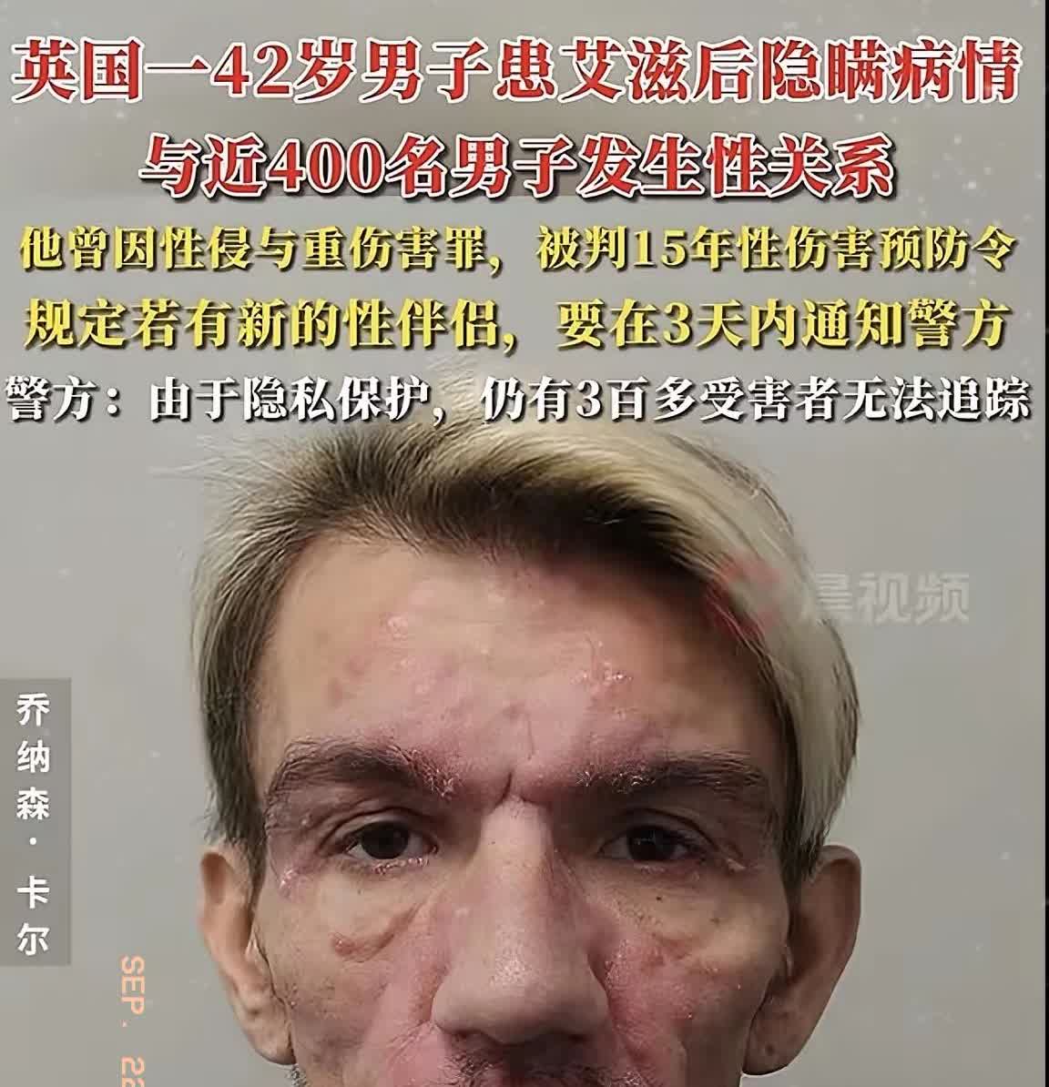 太恐怖了！英国出现个“病毒传播者”。一名42岁男子，明明身患艾滋病，却蓄