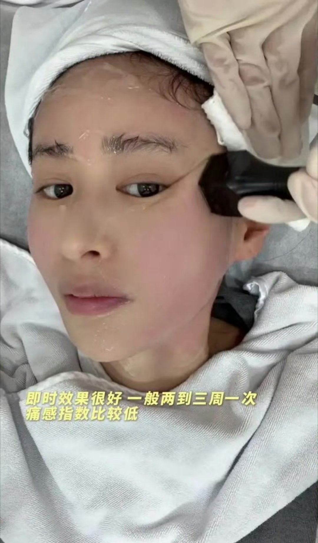 颖儿做眼部热玛吉疼哭了不敢看第二遍太疼了光是看着我的手心都出汗了