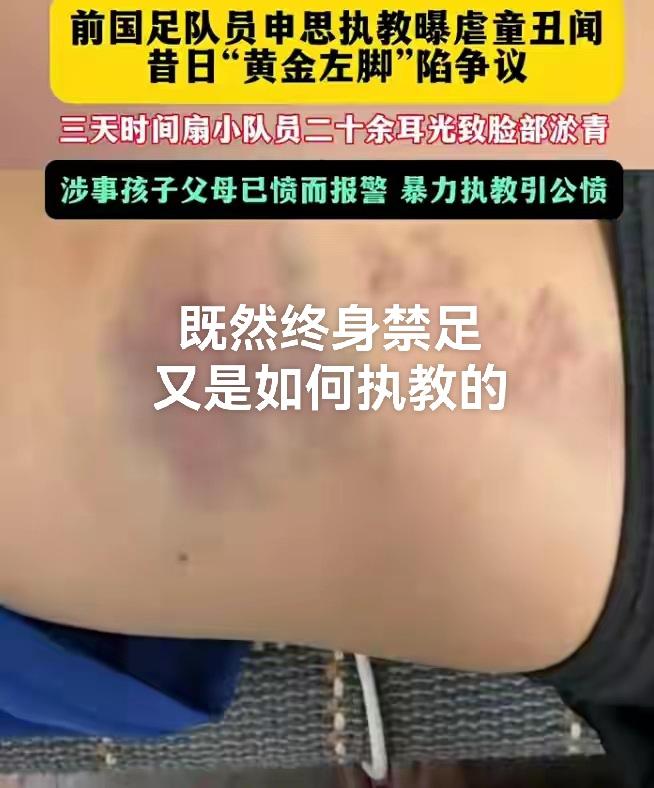3天扇了青训小队员20多个耳光，这是什么青训模式？问题的关键是申思祁宏遭终身禁足