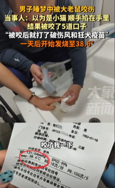太可怕！江苏无锡，男子晚上在家睡觉，半夜迷迷糊糊地感觉手上有什么毛绒绒的东西在动