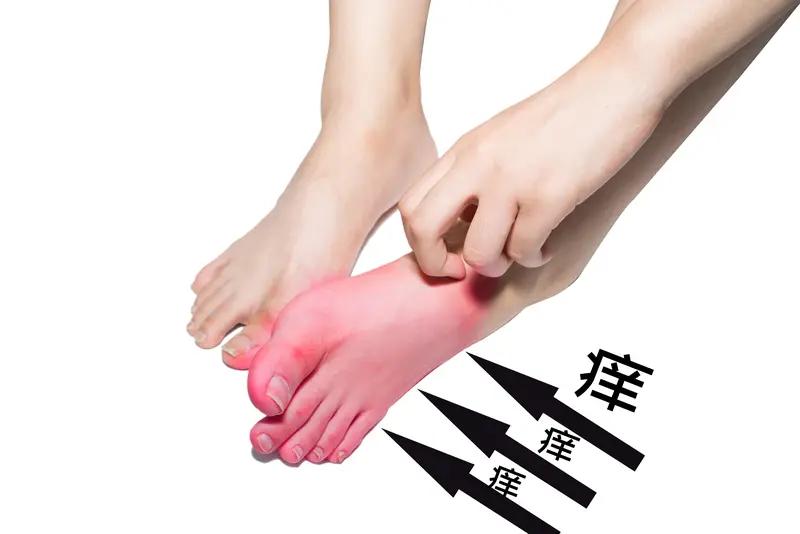 痛风这病真让人头疼，到底能不能彻底治好，还真不好说。痛风是尿酸盐结晶沉积在关节