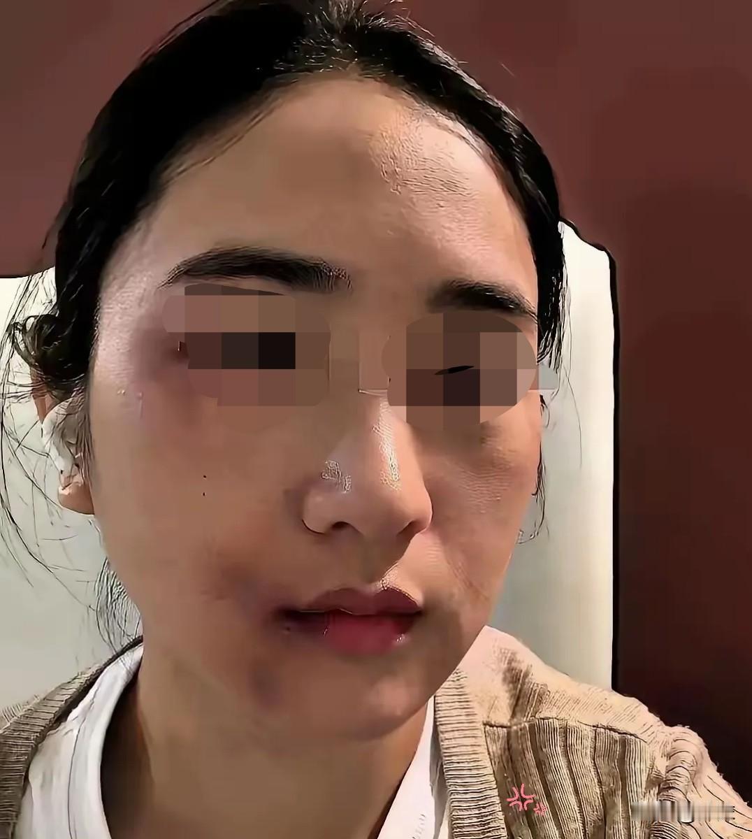 他揍我的第三天，突然查出了肝癌晚期。医生说赶紧换肝，准备70万。病房外他