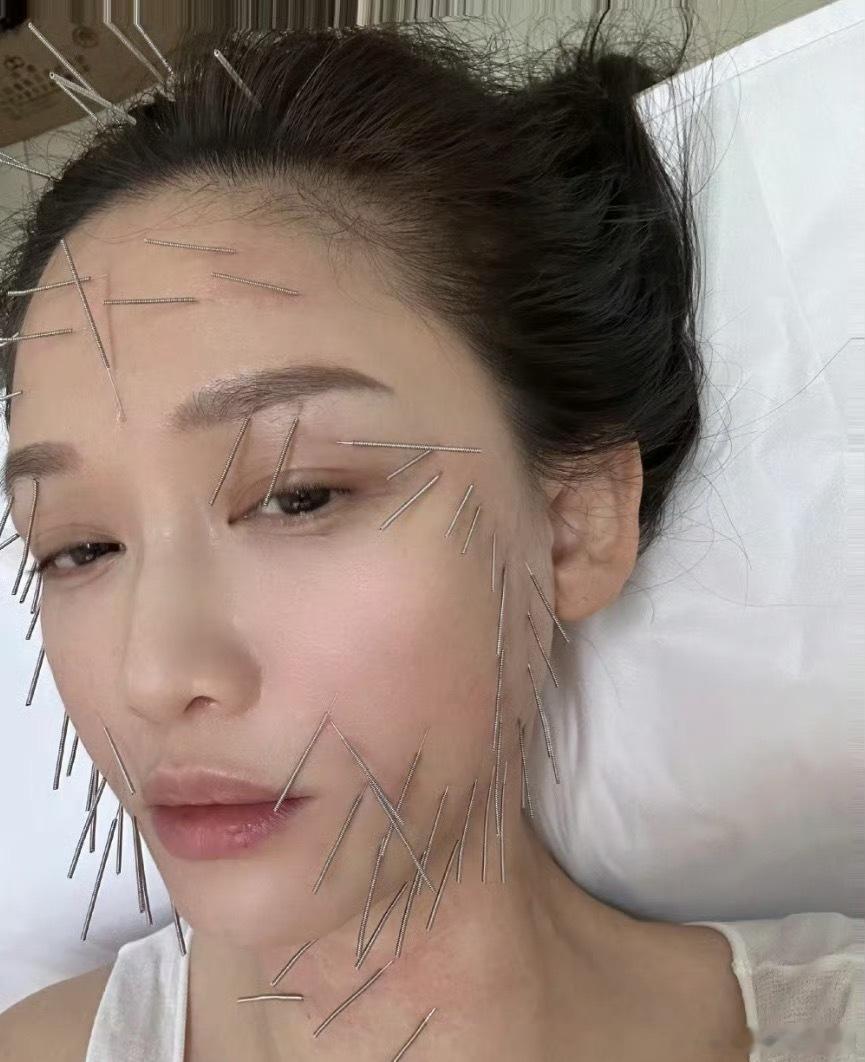 看着都疼[捂脸哭]​​​