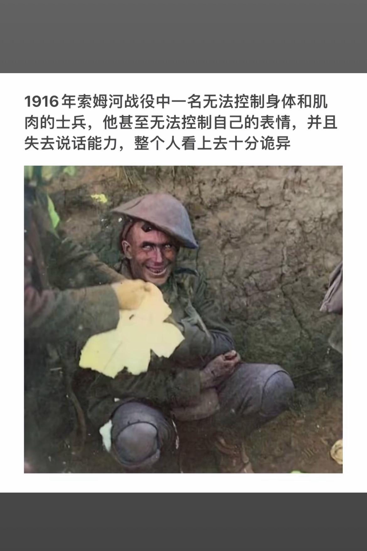 一战索姆河战役中，士兵的诡异表情令人毛骨悚然
