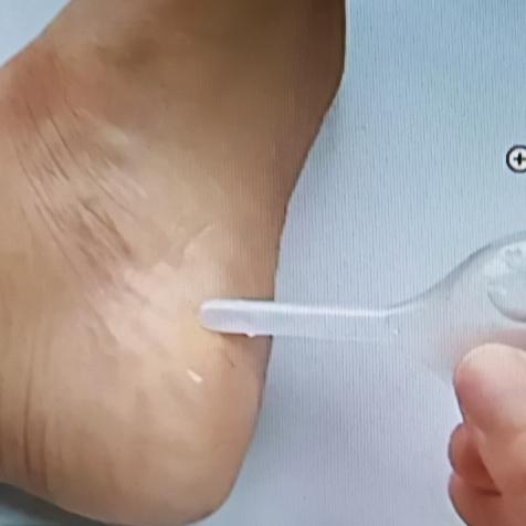 睡前把开塞露涂脚底这事，还真挺神奇。开塞露主要成分是甘油和水，甘油有保湿作用。当